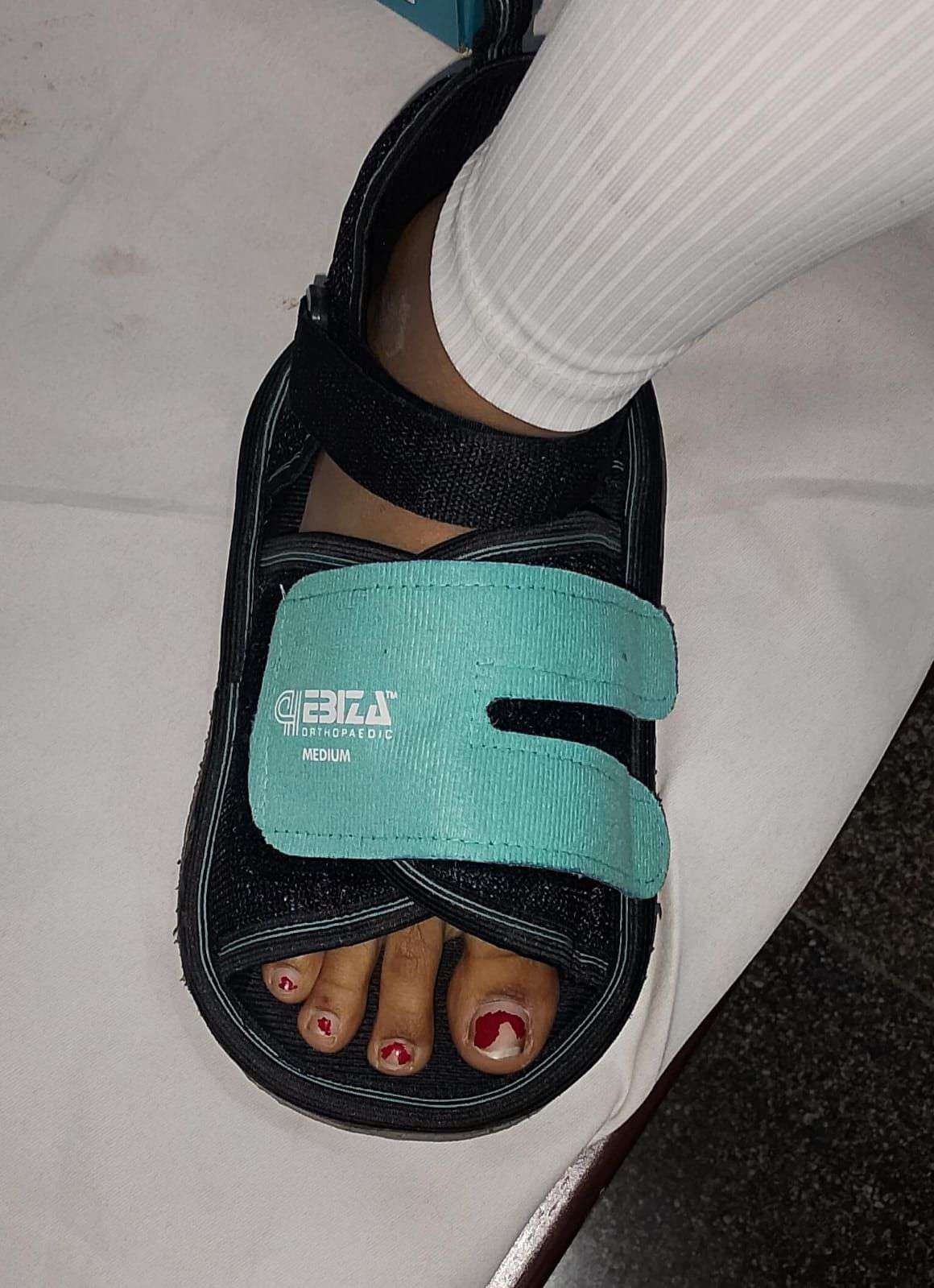 Cast Shoe